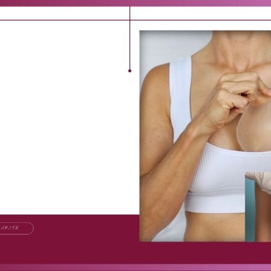Breast Prostheses